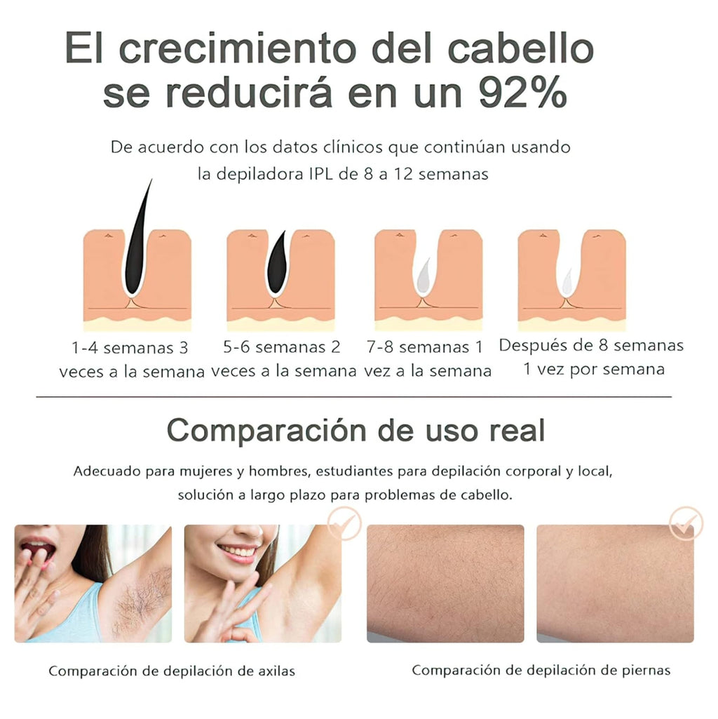 DEPILADORA LASER IPL