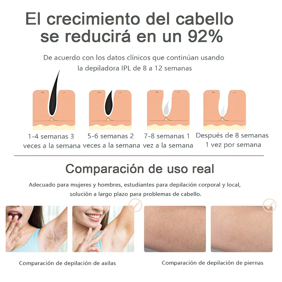 DEPILADORA LASER IPL